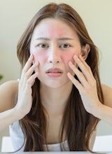 5 señales para saber si tienes piel sensible