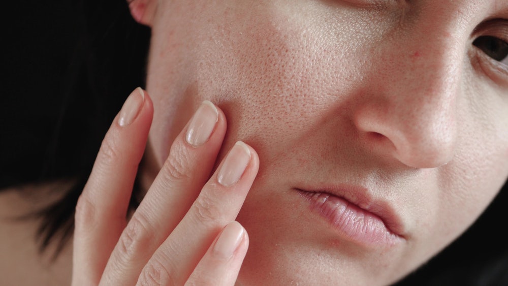 Sensitive Skin Causes & How To Care For It