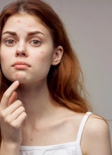 La guía definitiva para prevenir y controlar el acné por estrés en épocas de universidad